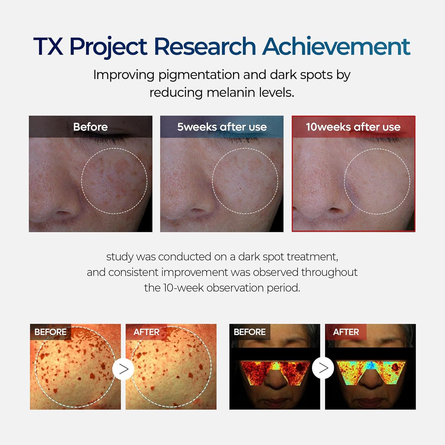 TX Tranexamic Acid Cream for Dark Spots, Hyperpigmentation and Uneven Tone