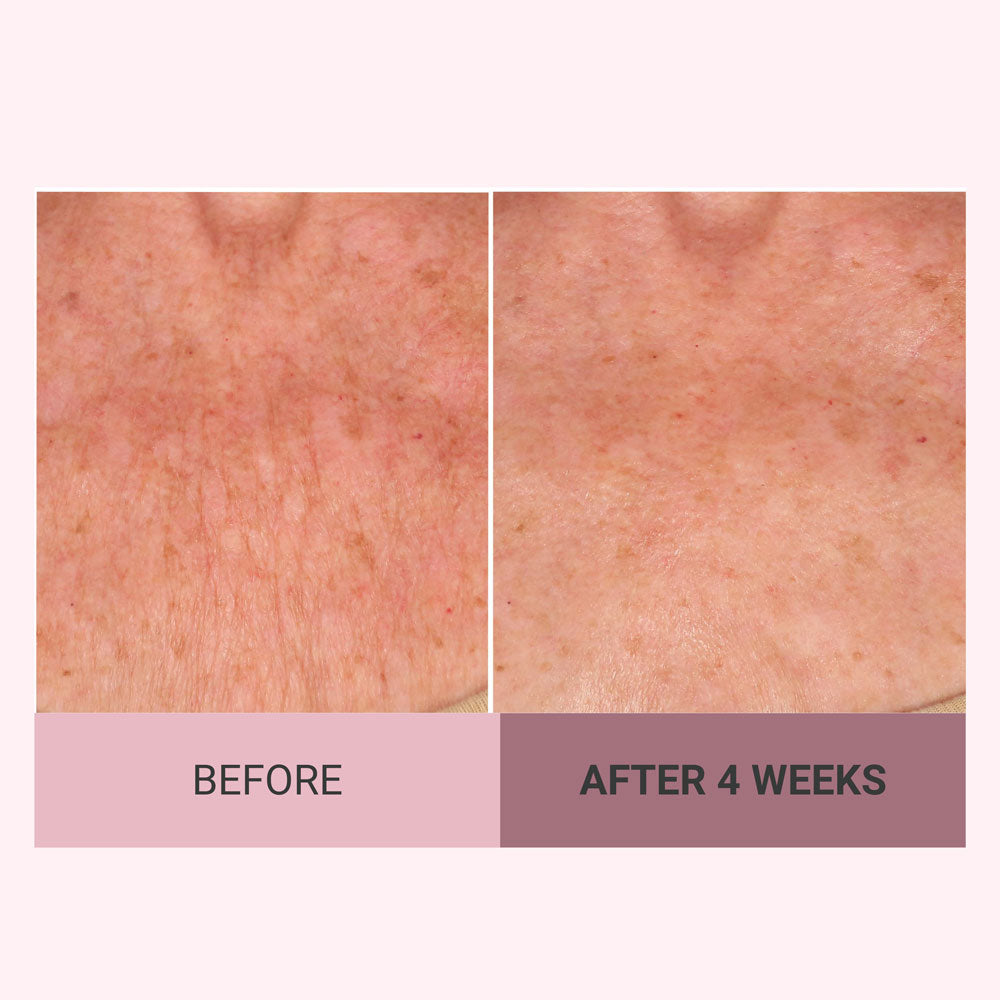 Champagne Beaute Lift Firming Body Cream with Luxe-Lift Complex and Pink Pepperslim