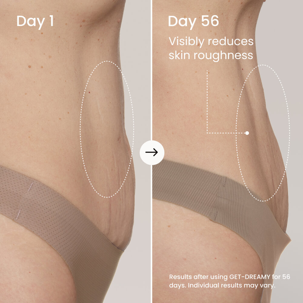 GET-DREAMY Overnight Toning Body Whip with Milk Thistle and Magnesium