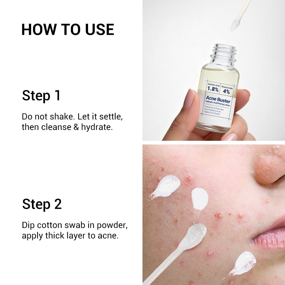 Acne Drying Lotion with Encapsulated Salicylic Acid, Sulfur and Niacinamide