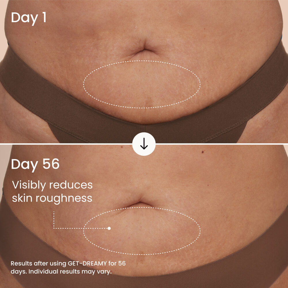 GET-DREAMY Overnight Toning Body Whip with Milk Thistle and Magnesium